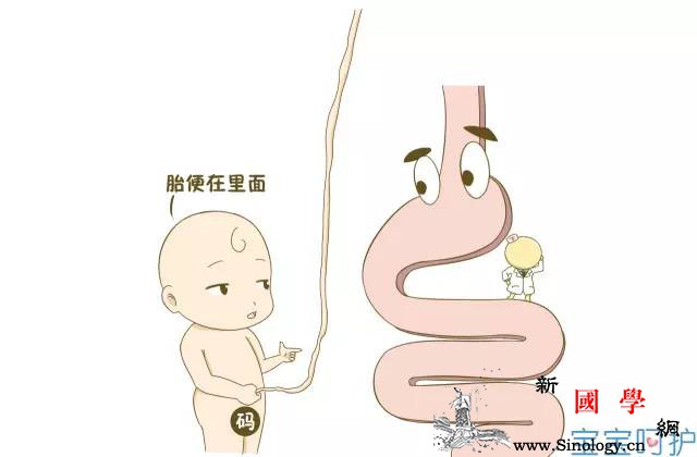 重口危险胎宝宝在肚子里吃！粑！粑！_羊水-肛门-综合征-吸入-