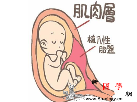 孕妇前置胎盘有什么危害_胎盘-植入-剥离-产后-