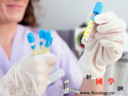 白带怎么检查_白带-外阴-分泌物-尿道-