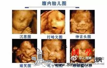 孕期检查之大畸形筛查_孕期-超声-胎儿-畸形-
