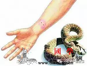 怀孕6个月手被大蛇咬打不打血清药？胎儿能不_血清-胎儿-孕妇-蛇咬伤-