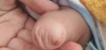 妈妈孕期常喝这个导致宝宝出生的时候少了一只_碳酸-孕妇-您的-饮料-