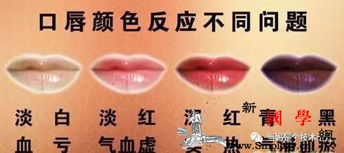 孕期得了这个病很难看出！却会对准妈造成无形伤_孕期-贫血-胎儿-症状-