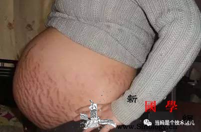 女人怀孕最大的代价是它了!长了一辈子消不了!_按压-腹部-肚子-妊娠纹-