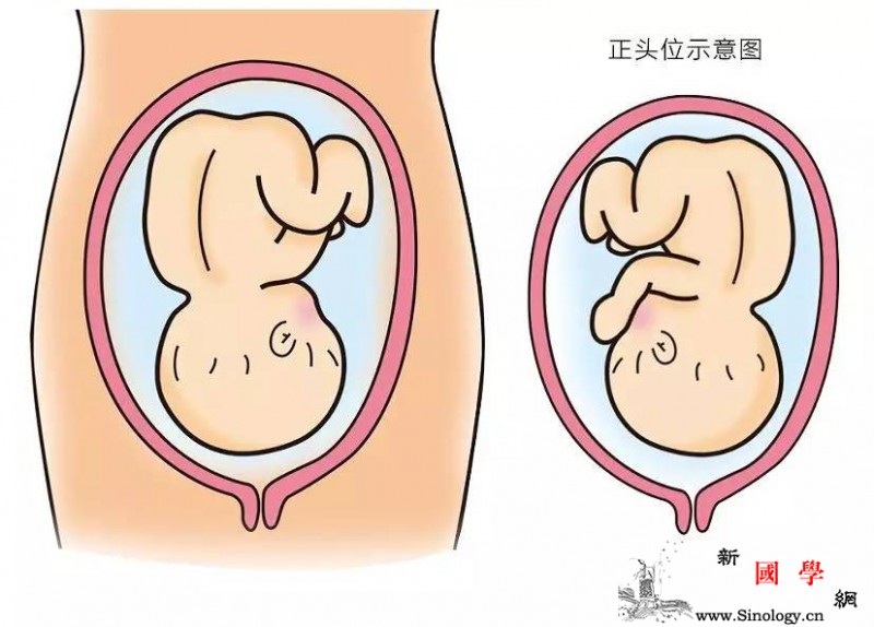 如果胎位不正就只能剖宫产吗？_胎位-胎儿-阴道-子宫-