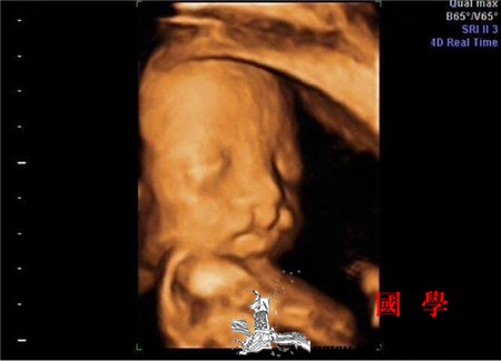 24周胎儿四维彩超_股骨-脐带-胎儿-分辨-