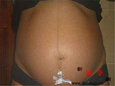 妊娠线什么时候长_线形-什么时候-孕期-妊娠-