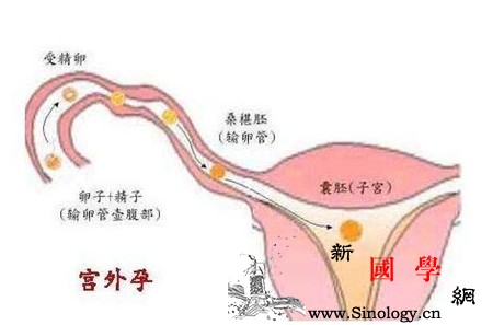 宫外孕多少天有症状_停经-宫外孕-输卵管-晕厥-