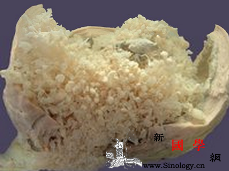 葡萄胎是怎么回事_葡萄胎-叶酸-胎盘-胚胎-