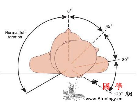 小儿斜颈推拿多久见好告诉你斜颈按摩多久才有_斜颈-见好-推拿-告诉你-