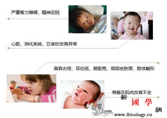 不想产下“唐氏儿”孕妈妈提前看！_染色体-羊膜-筛查-检测-
