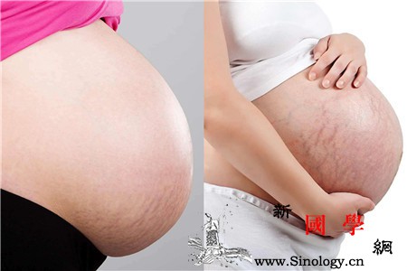 防妊娠纹用什么橄榄油选对产品才真正有效果_橄榄油-涂抹-产后-肚皮-