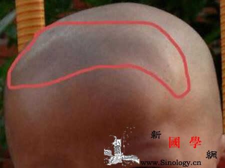 宝宝囟门异常情况是怎么回事七种异常情况原因_囟门-所致-异常-情况-