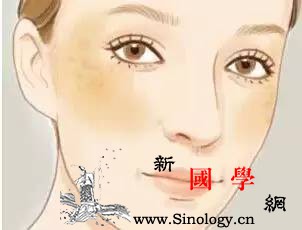 孕期如何防治妊娠斑_日晒-刺激性-孕期-妊娠-