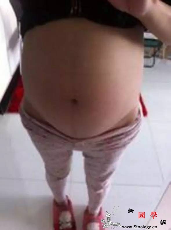 胎儿五个月产妇喝了口井水到医院一检查肚子_胎儿-医院-井水-产妇-