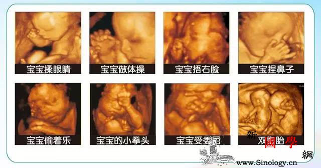 胎宝宝肚子里做鬼脸？他们每天在肚子里都干些啥_羊水-脐带-打嗝-胎儿-