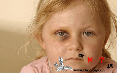 在幼儿园被打了你会教孩子怎么做？_打了-怎么做-幼儿园-妈妈-