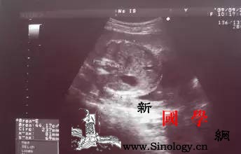 怀孕6个月肚子里却没孩子？医生说这是“葡萄胎_葡萄胎-水泡-妊娠-停经-
