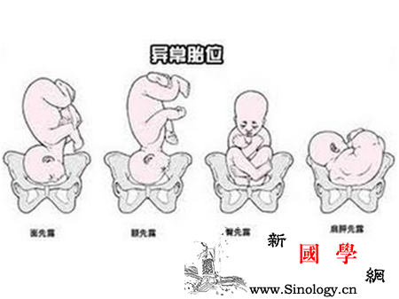 胎位不正是什么意思全面详解胎位不正_纵轴-胎位-骨盆-颜面-