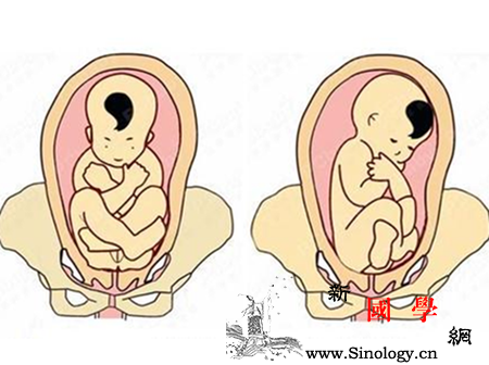 胎位不正分几种胎位不正有哪些_耻骨-胎位-几种-分娩-