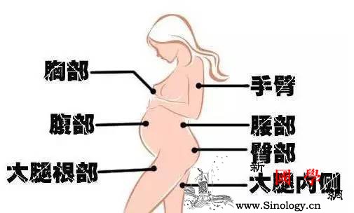 妊娠纹真的很会挑人看看你是不是那种容易出现_橄榄油-孕期-腹部-维生素-