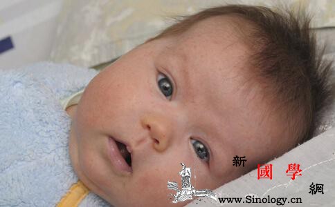 冬天宝宝会长湿疹吗_湿疹-会长-干燥-冬天-