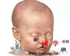 吃兔肉导致胎儿唇腭裂？兔子说：这个锅我不背！_兔唇-兔肉-胎儿-孕妇-