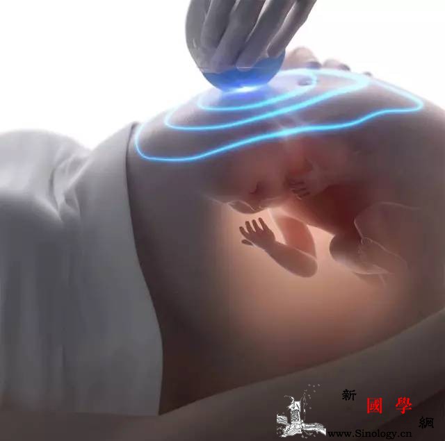 做超声影像（四维彩超）时如何让胎宝宝翻身配_胎动-超声-检查-宝宝-