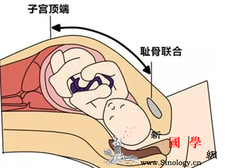 宫高怎么量教你正确测量宫高的方法_软尺-耻骨-子宫-孕妇-