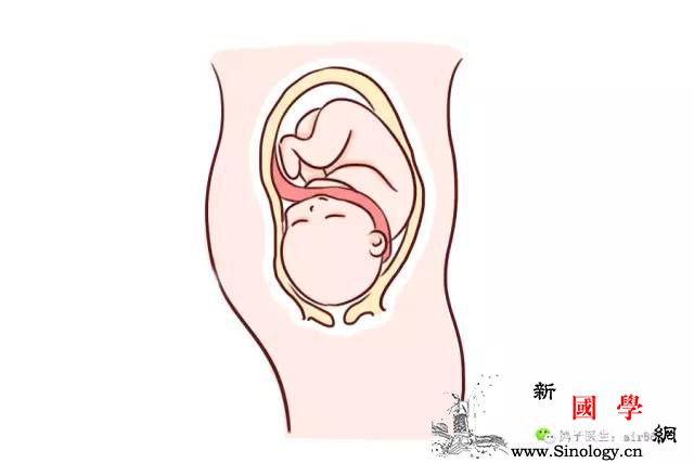 脐带绕颈只能剖腹产？那是你不了解这几点_胎动-脐带-情况-宝宝-