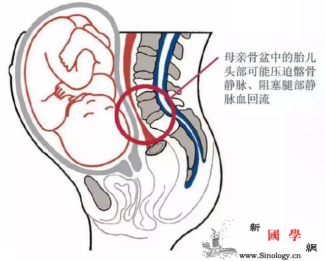 孕期脚肿腿肿怎么破？_浮肿-回流-水肿-孕期-