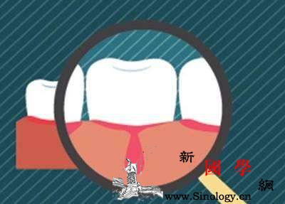 小儿血友病的症状有哪些_血友病-屈曲-血肿-关节-