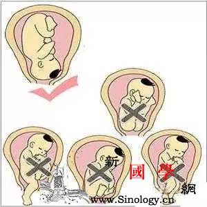 怀孕几个月可以定胎位？_胎位-羊水-分娩-胎儿-