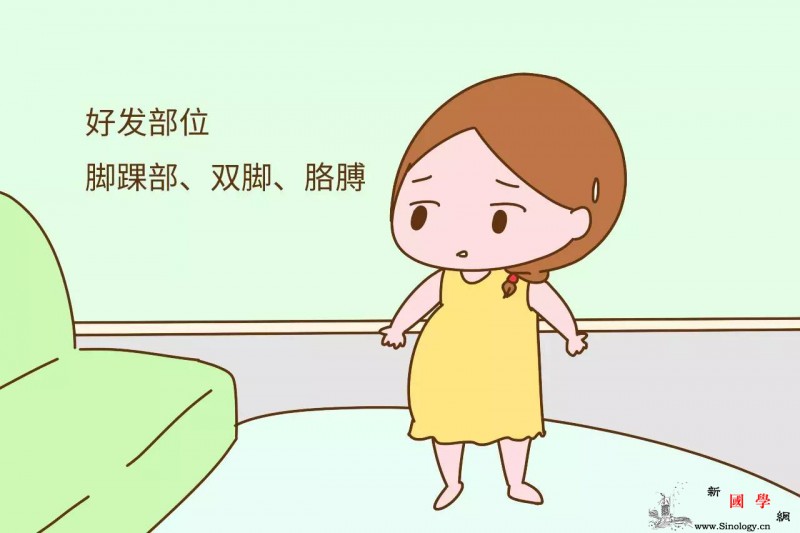 孕晚期出现水肿怎么回事？这几点一定要注意_水肿-孕期-导致-几点-