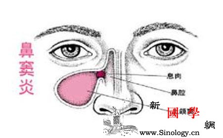 小儿鼻炎和鼻窦炎有什么区别_鼻窦炎-鼻窦-鼻腔-粘膜-