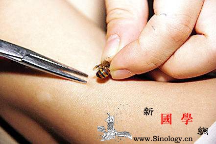 宝宝被蜜蜂蛰了怎么处理_消毒液-毒液-患处-消肿-