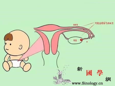小儿腹股沟斜疝是怎么引起的_腹膜-腹股沟-阴囊-睾丸-