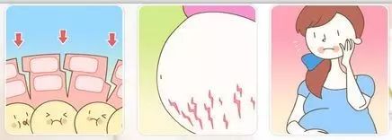 怀孕后肚子有条黑线它才不是从天而降呢!_黑线-肚脐-妊娠-怀孕后-