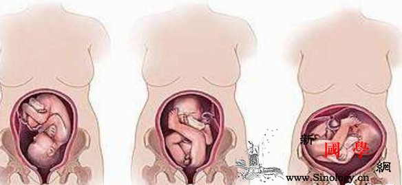 胎位不正是什么原因引起的？矫正胎位的两个方法_胎位-侧卧-矫正-胎儿-