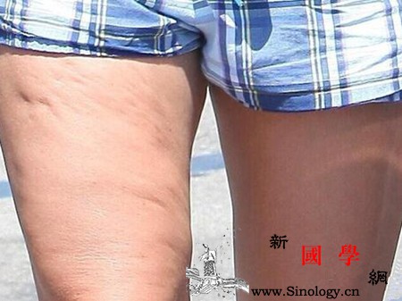 橘皮纹和妊娠纹的区别现在你能分清了吗_荷尔蒙-孕妇-区别-皮肤-