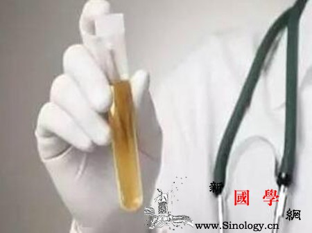 孕妇为什么每次都尿检以便及早发现这些孕期疾_尿检-肾脏-孕妇-尿糖-