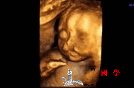 孕妇孕期常做一件事四维检查后医生说胎儿“兔_腭裂-孕期-胎儿-张女士-