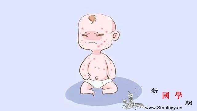 孕晚期的女性都要“祛胎毒”不注意的会让宝宝_胎毒-宝宝-女性-会让-