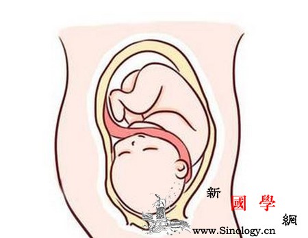 孕妈的这几个行为很容易造成胎儿脐带绕颈！_脐带-胎儿-抚摸-坐姿-