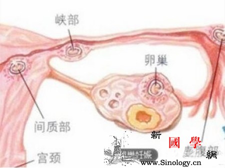 卵巢妊娠的临床表现_楔形-输卵管-卵巢-妊娠-