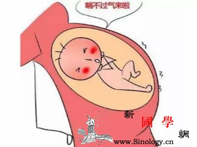 胎宝宝“脐带绕颈”孕妈该怎么做呢？_胎动-脐带-分娩-胎儿-