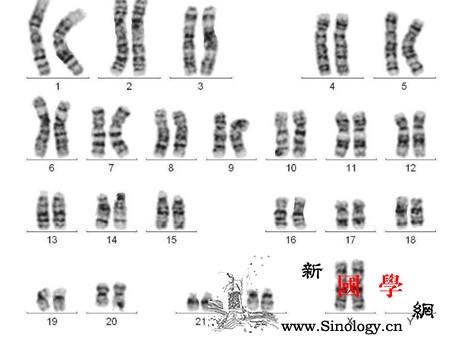 胎儿染色体非整倍体是什么意思_羊水-染色体-穿刺-母体-