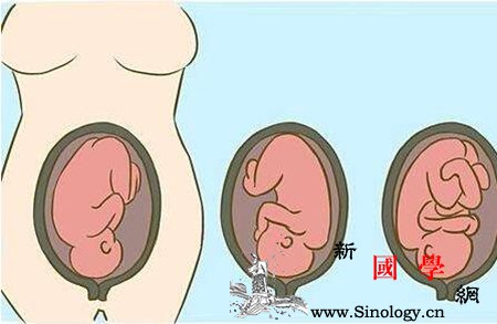 胎位有哪几种警惕胎儿臀位横位_胎位-骨盆-几种-胎儿-