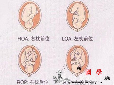 胎位loa和roa的区别胎位又该怎样写_枕骨-胎位-顺产-胎动-